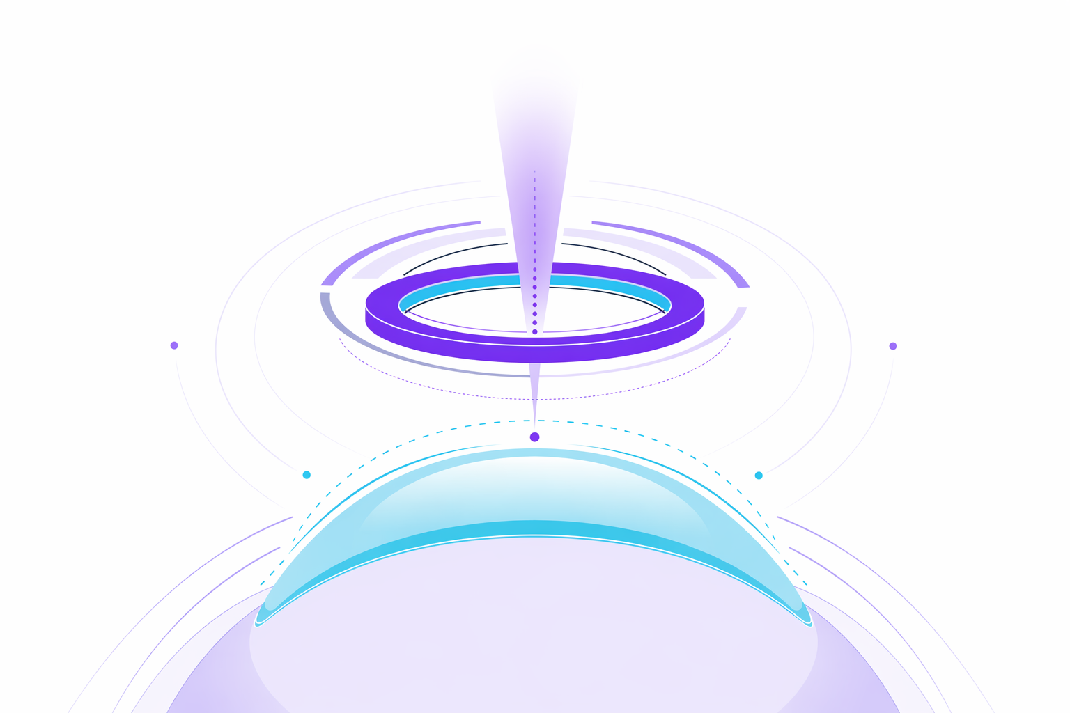 Illustration for LASIK eye surgery