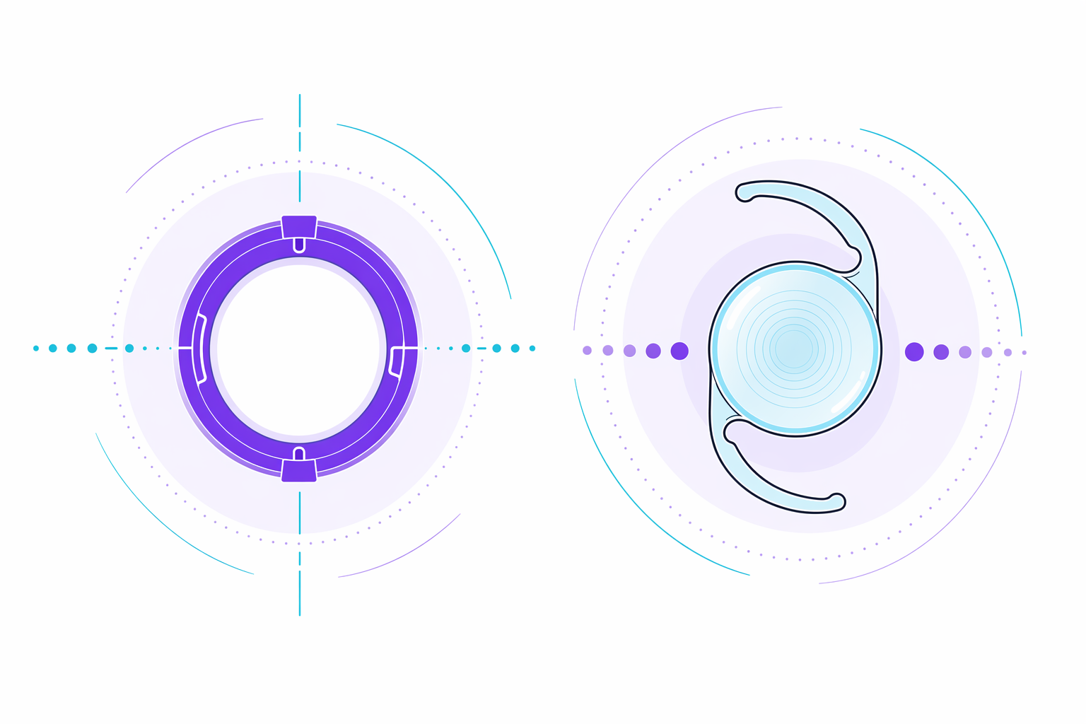 Illustration for LASIK vs ICL