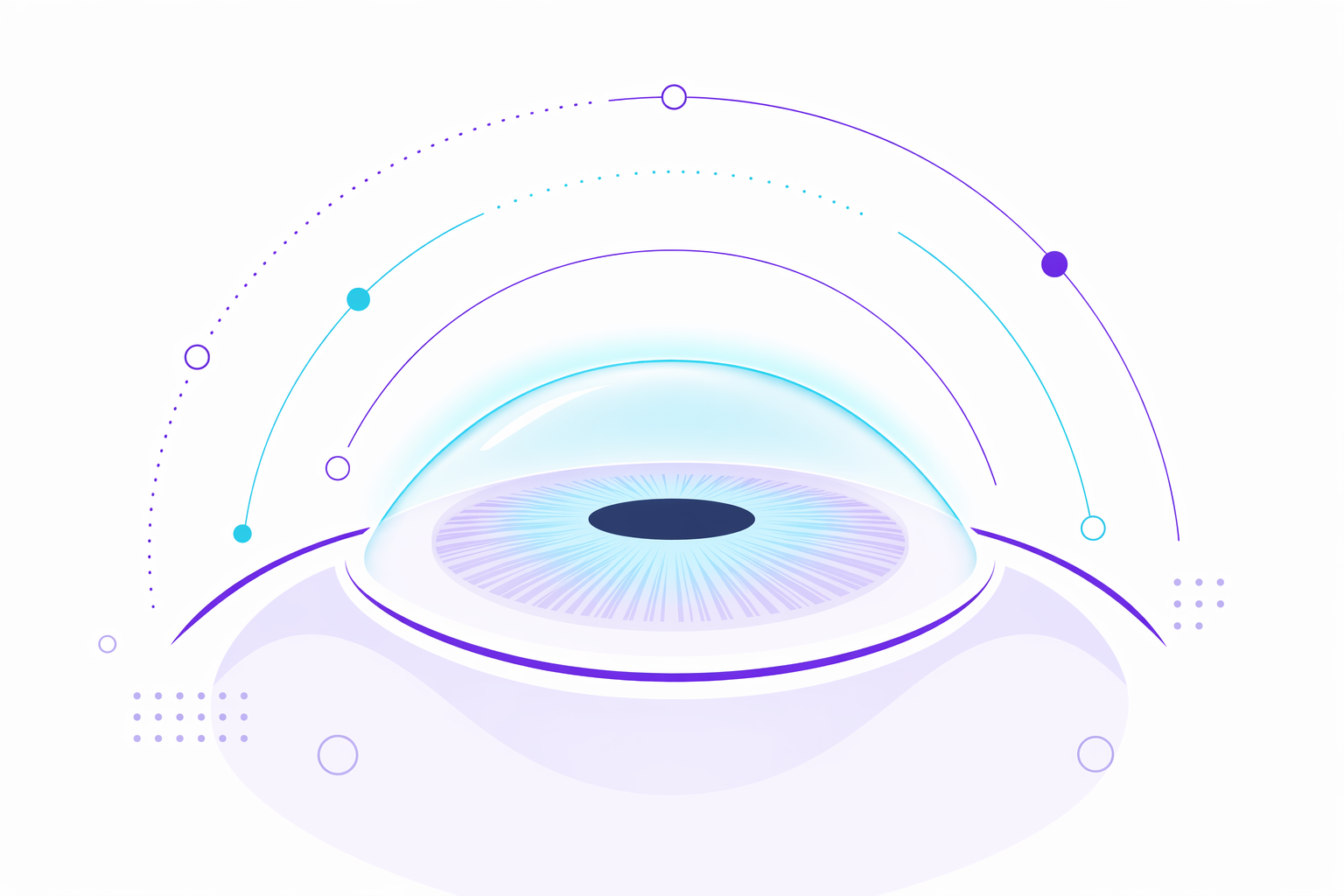 Illustration for PRK eye surgery